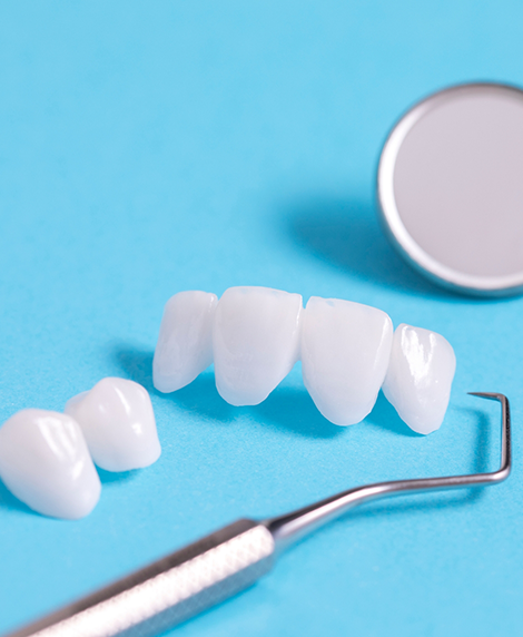 Dental bridge in Coral Springs next to a dental mirror