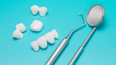 Dental mirror laying next to a dental bridge