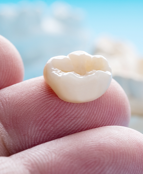 Dental crown resting on a person's finger