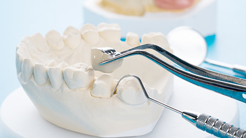 Tweezers placing a dental crown over a tooth model