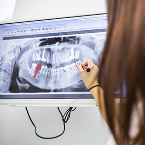 Dentist showing an x ray of teeth to a patient
