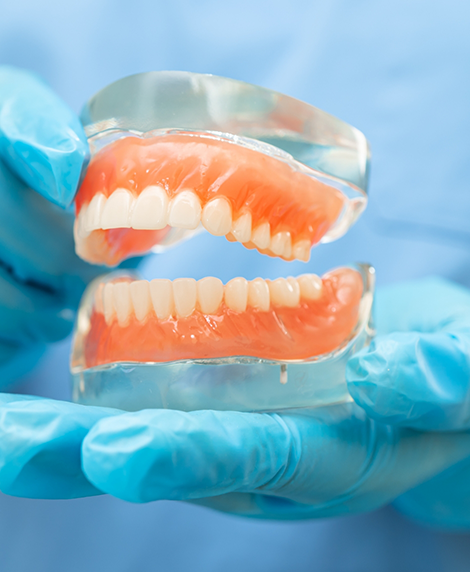 Dentist holding a model of dentures in Coral Springs