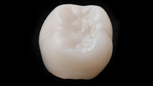 Tooth colored dental crown against a black background