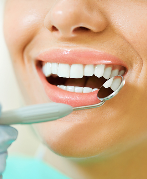 Close up of a person smiling during a preventive dental exam
