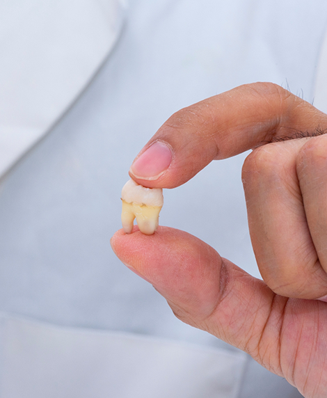 Person holding an extracted tooth