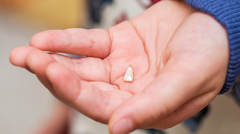 Hand holding an extracted tooth