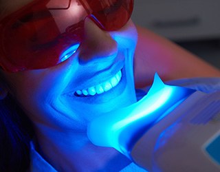 Picture of in-office teeth whitening